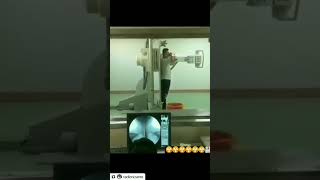 Barium swello radiologycareer radiographer neet radiology trending trendingshorts [upl. by Hallee]