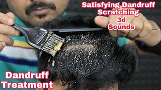 Satisfying Dandruff Scratching ASMR Dandruff Treatment by biswajit barber [upl. by Coulombe449]