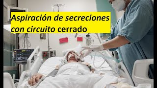 Aspiración de secreciones con circuito cerrado [upl. by Damarra]