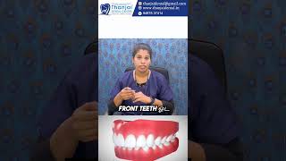 Overjet னா என்ன overbite னா என்ன  thanjaidental dentalcare oralhealth [upl. by Chlori]