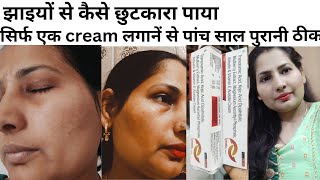 Cream For Pigmentation Pigmentation Removal Cream Skin Whitening Cream  झाइयां। [upl. by Rammaj]