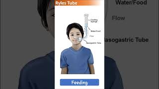 Ryles tube colour and size l Ryles tube l NG tube l OG tube [upl. by Ronoel905]