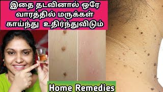 How to remove skin tags at home in One week 😱 [upl. by Perri]