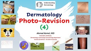 Dermatology Photo Revision 4 [upl. by Weinreb]