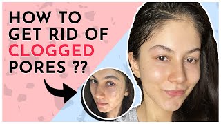 How To Get Rid Of Clogged Pores [upl. by Letizia]