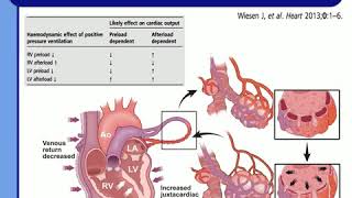 UNDERSTAND CARDIOPULMONARY INTERACT TO AVOID CLINICAL DISASTERS JD Chiche 2015 [upl. by Onnem505]