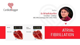 Understanding Atrial Fibrillation AFib Causes Symptoms and Treatment  Cardioblogger [upl. by Ynoffit]