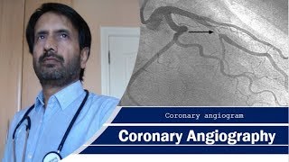 The Angiography Angiogram Procedure  How do doctors perform this procedure [upl. by Jorge]