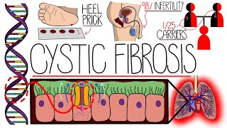 Understanding Cystic Fibrosis Includes Pathophysiology amp Diagnosis [upl. by Nnylyak]