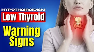 How To Spot Symptoms Of Thyroid Problems [upl. by Jemie429]