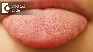 What causes small red patches on tongue  Dr Sana Taher [upl. by Edivad842]