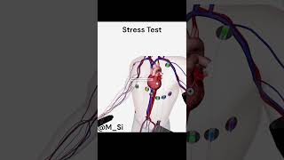 Stress Test [upl. by Irrabaj576]