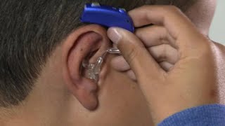 How to place Oticon Sensei BTE hearing aid with mould [upl. by Ahseinaj]