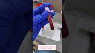 Hba1c test laboratorylife hba1c bloodsugar bloodcollection ytshorts bloodtest ytstudio rbc [upl. by Ellehsor]