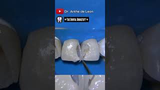 Amazing Restoration of the Patients Confidence dental oralhealth dentalcare [upl. by Freud]