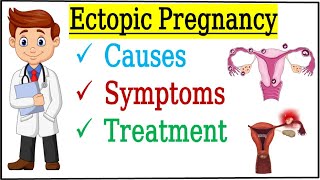 Ectopic Pregnancy  How to Diagnosis  Causes Symptoms Treatment of Ectopic Pregnancy  Animated [upl. by Htnamas273]