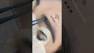 eyebrow transplantation eyebrow eyebrows sopracciglio sobrancrlhas cejas sourcils eyelashes [upl. by Iaria110]