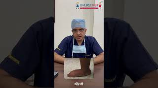 फ्लैट फ़ीट फ्लेक्सिबल हे या रिजिड  Dr Gaurav Gupta  Child Orthopedic Surgeon in Delhi [upl. by Iives]