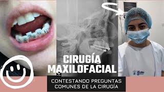 20 Preguntas frecuentes de la cirugía maxilofacial [upl. by Iad]