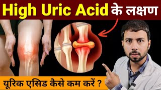 यूरिक एसिड कैसे काम करें   how to control uric acid naturally  High uric acid Symptoms [upl. by Ehlke]