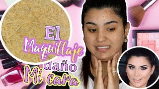 Daño mi Cara el maquillaje La verdad de mi acne manchas e imperfecciones  Roccibella [upl. by Atteyek]