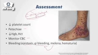 Thrombocytopenia NCLEX® Review  NRSNGacademycom [upl. by Aihcila]