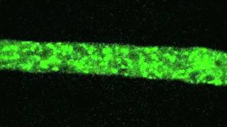 Neurospora organelle structuremov [upl. by Htebaras]