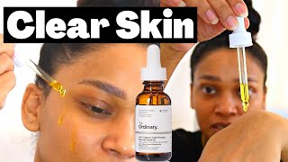 The Ordinary 100 Organic Cold Pressed Rosehip Seed Oil  Results after 6 Months  Best Face Oil [upl. by Hallee]