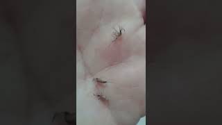 fumigacion dengue culex aedes anopheles [upl. by Lisab]