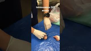 Paramedic Student Intraosseous IO access paramedic ioaccess [upl. by Garlen]