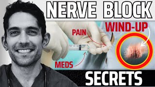 What they dont tell you about nerve blocks before surgery Live DEMO [upl. by Giorgio]