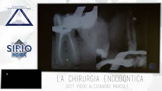 1Corso Di Endodonzia Chirurgica Parte 1 1 [upl. by Thaddaus310]