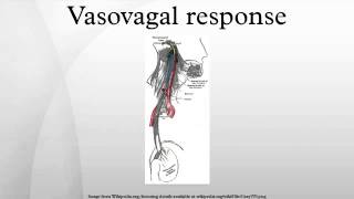 Vasovagal response [upl. by Marilee]