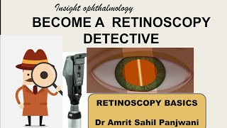 Important Concepts in RETINOSCOPY [upl. by Elttil]