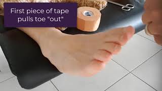 How To Hold A Curly Pinky Toe Straight With Tape [upl. by Rosenstein]