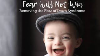 The changes in the child with Down Syndrome after therapy [upl. by Heloise656]