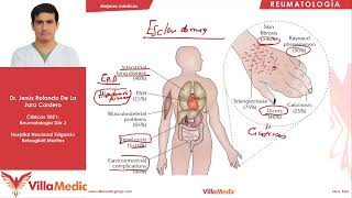 Esclerosis sistémica  Reumatología  Villamedic Clínicas 2021 [upl. by Kaufman]