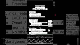 Peripartum cardiomyopathy [upl. by Nats]