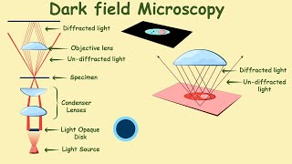 Dark field microscopy  Dark field microscope  dark field microscopy in hindi  Urdu  Microbiology [upl. by Einnahpets702]