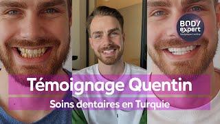 SOINS DENTAIRES EN TURQUIE  🦷 Témoignage de Quentin  24 couronnes Emax  BODYEXPERT [upl. by Assenaj]