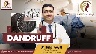 How an Oily Scalp Causes Dandruff and Why You Should Avoid Hair Oils  Dr Rahul Goyal dandruff [upl. by Annim]