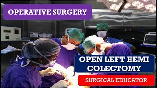 OPEN LEFT HEMICOLECTOMY STEP BY STEP Operative Surgery [upl. by Brietta]