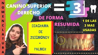 ZSIGMONDY  PALMER DIAGRAMA O NOMENCLATURA [upl. by Cornie]