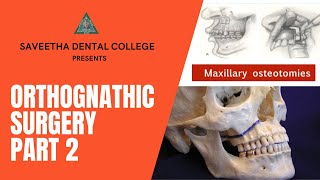 ORTHOGNATHIC SURGERY PART 2 [upl. by Gwenore]