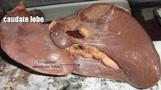 Boundary of caudate and quadrate lobe of Liver  Lobes of Liver  Liver anatomy [upl. by Emee]