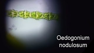 Oedogonium nodulosum [upl. by Land]