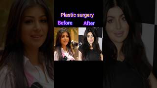 Actress before amp after plastic surgery👀😫viralshortsubscribe [upl. by Schober]