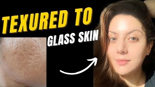 How to treat textured skin  Bumpy skin texture I Closed comedones treatment  Pitted scar treatment [upl. by Amiarom170]