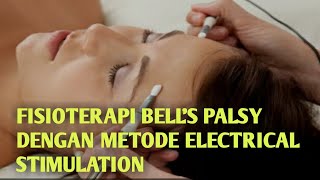 FISIOTERAPI BELLS PALSY DENGAN METODE ELECTRICAL STIMULATION [upl. by Perl]