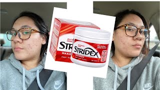 TRYING STRIDEX FOR A WEEK  MY ACNE JOURNEY [upl. by Adnwahsar]